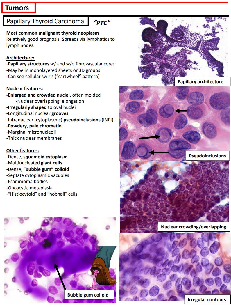 KurtSchaberg's tweet photo. I just updated my Thyroid Cytology notes on my teaching website, "Kurt's Notes" (https://t.co/OKmaPvGQpJ) to incorporate the newest Bethesda system.

🔬🔬🔬🔬🔬🔬🔬🔬🔬🔬🔬🔬🔬🔬🔬🔬🔬🔬🔬🔬🔬🔬🔬🔬🔬🔬🔬

Full notes available here: https://t.co/dySy8TY6R1 https://t.co/zh7SfHRC9g