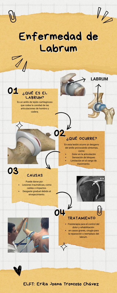 ErikaTC01's tweet photo. ENFERMEDAD DE LABRUM https://t.co/gR1gnwzn3p