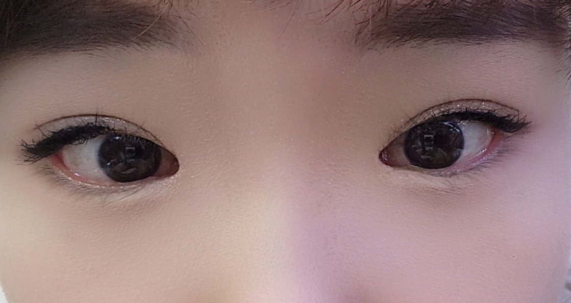 awt0728's tweet photo. 7/28に 二重切開+目頭切開+目付き矯正してほぼ4ヶ月目👀❤️
二重幅も安定した感じかな？
仕上がりが理想過ぎて毎日幸せ☺️
会う人会う人にすごい自然って羨ましがられるww👍👍
#ビュー美容外科 https://t.co/xM2U8Q2vt4