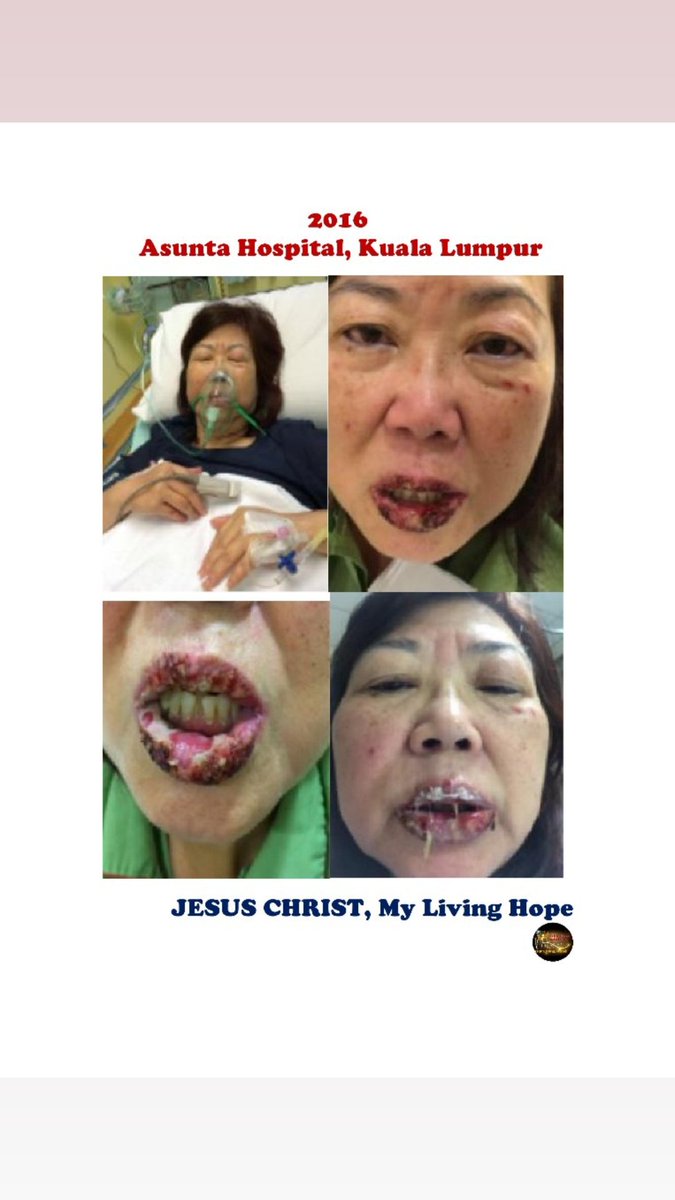 *Healing and Deliverance - ADVERSE INJURIES*   
Zoom meeting with Date: *Wed 6th Dec 2023*  
Time: *5pm*                
Zoom ID: 97966557708                   
Password: Jesus    
Speaker: Nancy Limmer