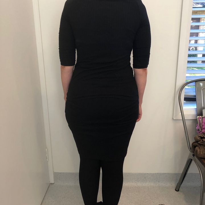 This beautiful patient has lost 11 kilos since January on Dr Jeff Walker's Weight Loss program! Her hard work and dedication has seriously paid off! Congratulations on your fabulous result!
All appointments (530) 331-0689
#portlandfood #eaterpdx #instagood #photooftheday #ripcity