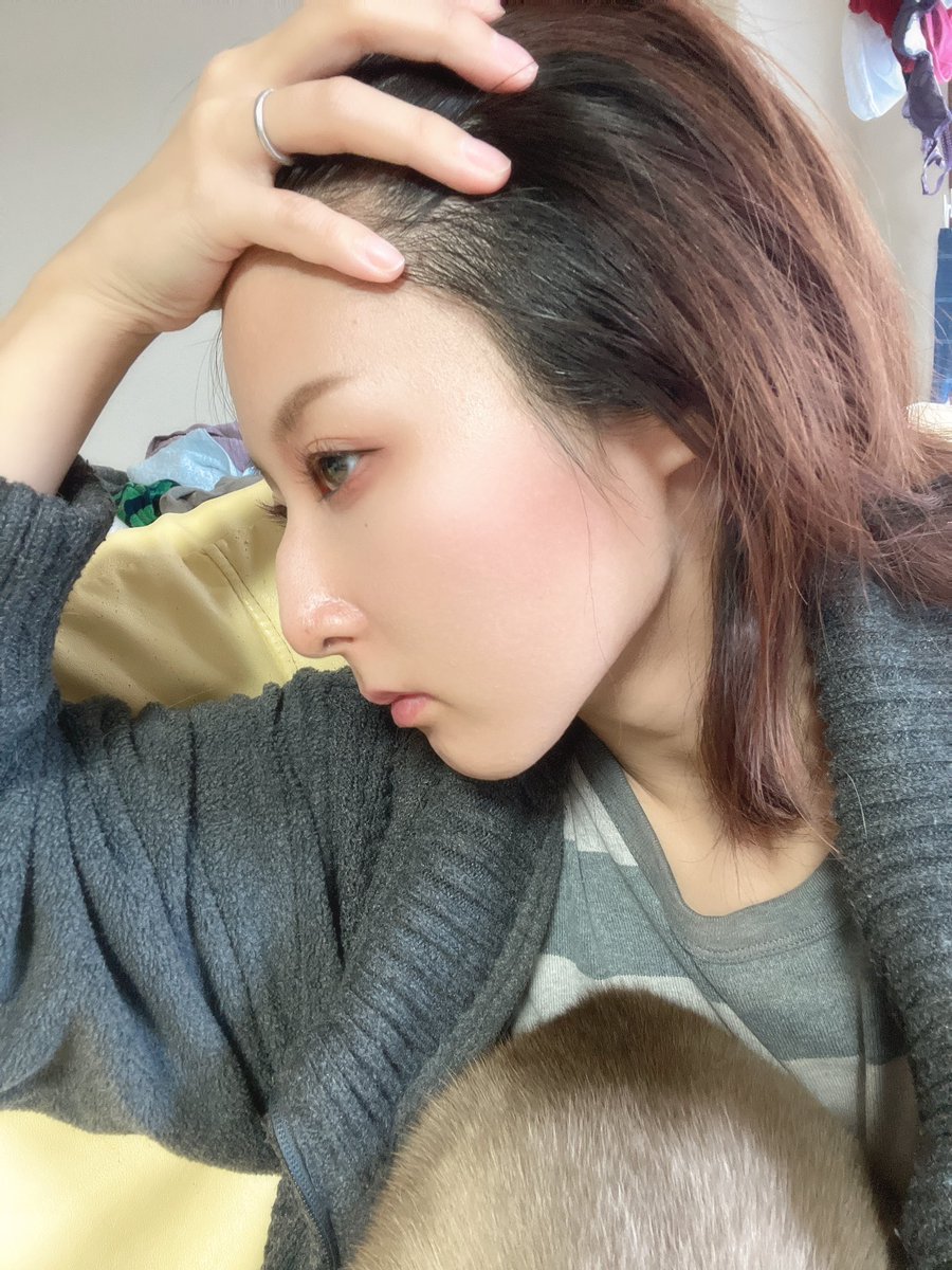 na0119nj's tweet photo. 鷲鼻で斜鼻なので顔の左側と右側で横顔の鼻の折れ曲がり具合全然違う無理。鼻中隔湾曲症とか斜鼻って保険でいくらくらいで手術出来るんですか😭😭😭
#鼻中隔湾曲症
#斜鼻
#歯列矯正 https://t.co/7tHmgaBPAg