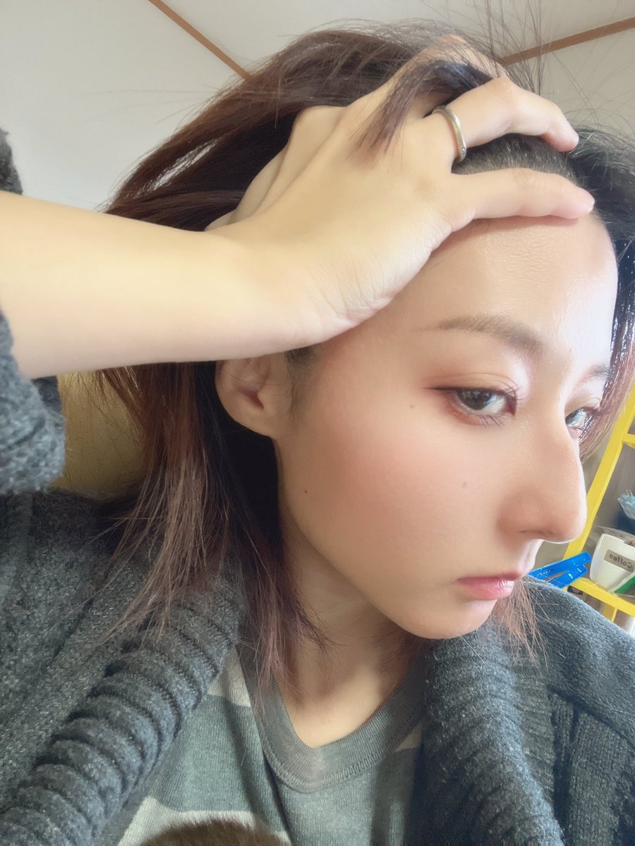 na0119nj's tweet photo. 鷲鼻で斜鼻なので顔の左側と右側で横顔の鼻の折れ曲がり具合全然違う無理。鼻中隔湾曲症とか斜鼻って保険でいくらくらいで手術出来るんですか😭😭😭
#鼻中隔湾曲症
#斜鼻
#歯列矯正 https://t.co/7tHmgaBPAg