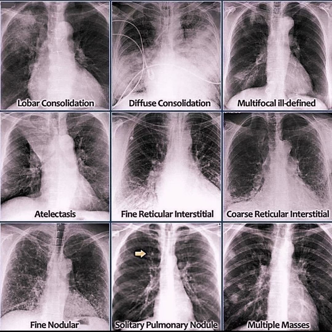 RespiratoryGate's tweet photo. https://t.co/2lZbZYqa6L