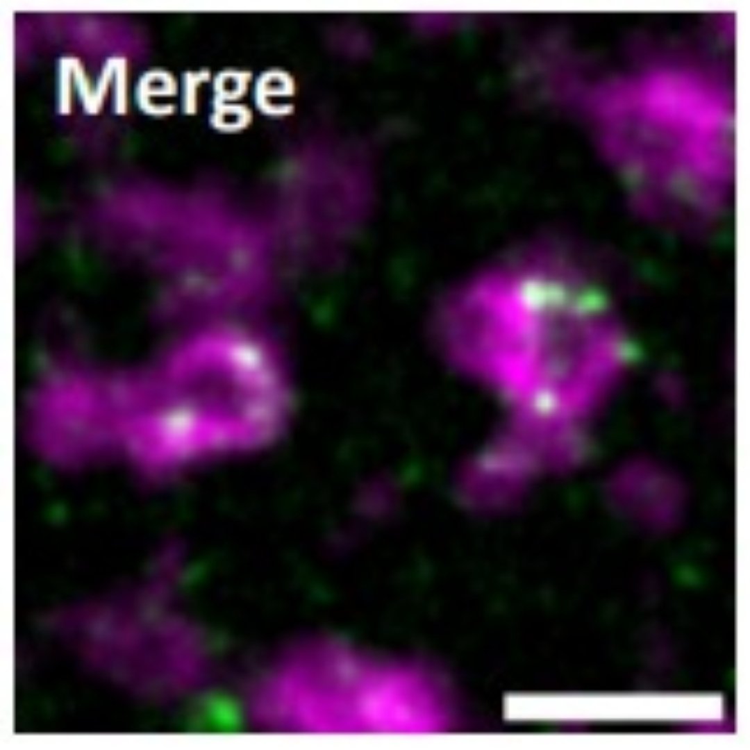 the_ali_haidar's tweet photo. Using #suntag to visualize ongoing #translation of germ granule #mRNA nos, we saw that it occurred specifically at the germ granules, localized at the shell and immediate periphery with PABP &amp; eIF3d, while mRNAs in the core showed no translation signal.(3/8) https://t.co/4Kcklb6Vaq