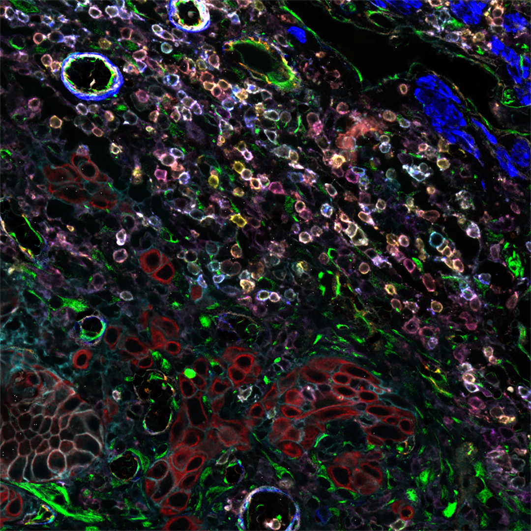 LeicaMicro's tweet photo. Sourcing and validating antibodies can be time-consuming & expensive. Save time and money on studies performed with validated antibodies available from @CellSignal Technology (CST) using the #CellDIVE multiplexed imaging workflow.
π https://t.co/5qdyaHWLkx
#MultiplexingMonday https://t.co/0eyErb285L