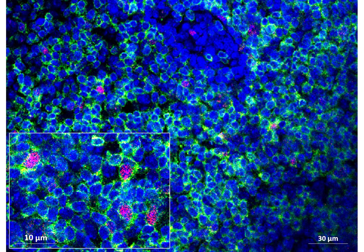 Inserm's tweet photo. Des chercheuses et chercheurs se sont intéressés au rôle du microbiote intestinal dans le développement de l’athérosclérose.  

👉#alimentation, #microbiote, #immunité, tout est lié !

https://t.co/51JwQzXKfJ https://t.co/3qP9B8VXn9