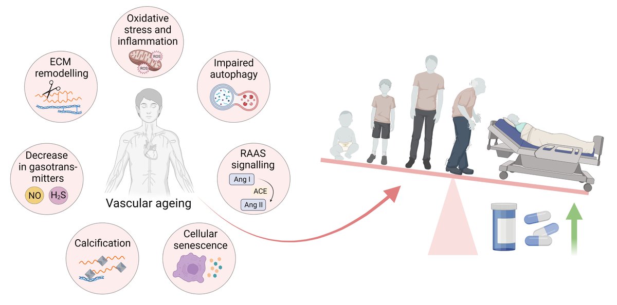 Lynn Roth (@lynnroth87) on Twitter photo 📢 Exciting News! 📚 Our Latest Publication in #AgeingResearchReviews on Pharmacological Modulation of Vascular Ageing is Now Available!
doi.org/10.1016/j.arr.…
Thank you to all the authors and <a href="/VascAgeNet/">VascAgeNet</a>! It truly was a team effort!
<a href="/Physphar/">Physiopharmacology Research Group</a> #VascularAgeing #teamwork 📢 Exciting News! 📚 Our Latest Publication in #AgeingResearchReviews on Pharmacological Modulation of Vascular Ageing is Now Available!
doi.org/10.1016/j.arr.…
Thank you to all the authors and <a href="/VascAgeNet/">VascAgeNet</a>! It truly was a team effort!
<a href="/Physphar/">Physiopharmacology Research Group</a> #VascularAgeing #teamwork