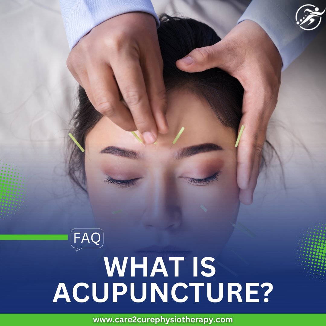 care2cure_'s tweet photo. Discover the ancient healing power of Acupuncture at Care2Cure! 🌟 Our expert treatments harmonize your body's energy flow, alleviating pain like neck, back, and knee discomfort. https://t.co/dp3pGEC0i8