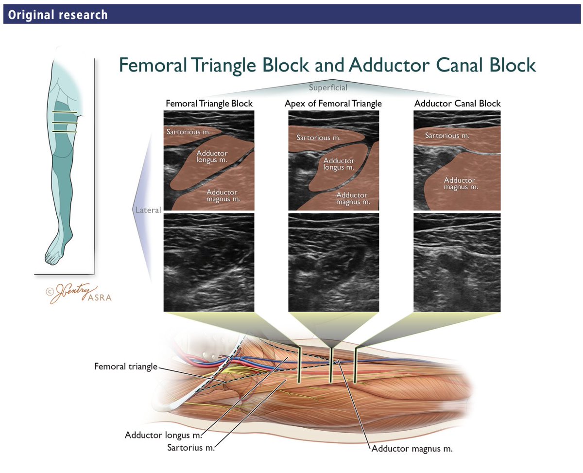 Nabil Elkassabany MD MBA MSCE tweet media