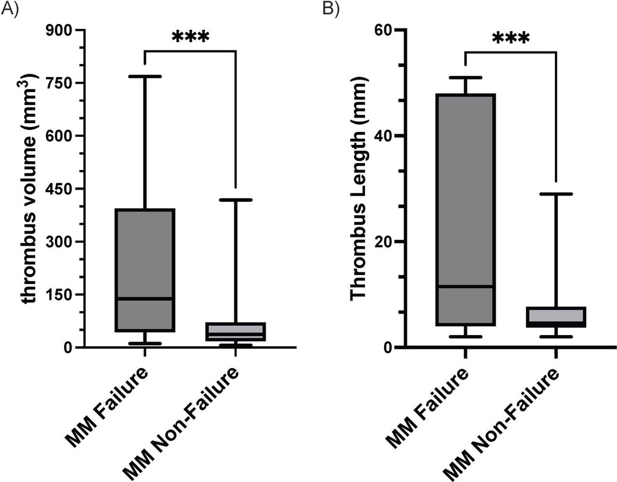 JNIS (@jnis_bmj) on Twitter photo <a href="/D_SchartzMD/">Derrek Schartz, MD</a>, <a href="/SajalAkkipeddi/">sajal.akkipeddi</a> demonstrate that thrombus volume of >= 90mm3 for free-floating thrombi will unlikely resolve with medical management (MM). 17% (7/41) failed MM in this cohort. Longer and bigger clots predict MM failure. Link: bit.ly/49VAm7J <a href="/D_SchartzMD/">Derrek Schartz, MD</a>, <a href="/SajalAkkipeddi/">sajal.akkipeddi</a> demonstrate that thrombus volume of >= 90mm3 for free-floating thrombi will unlikely resolve with medical management (MM). 17% (7/41) failed MM in this cohort. Longer and bigger clots predict MM failure. Link: bit.ly/49VAm7J
