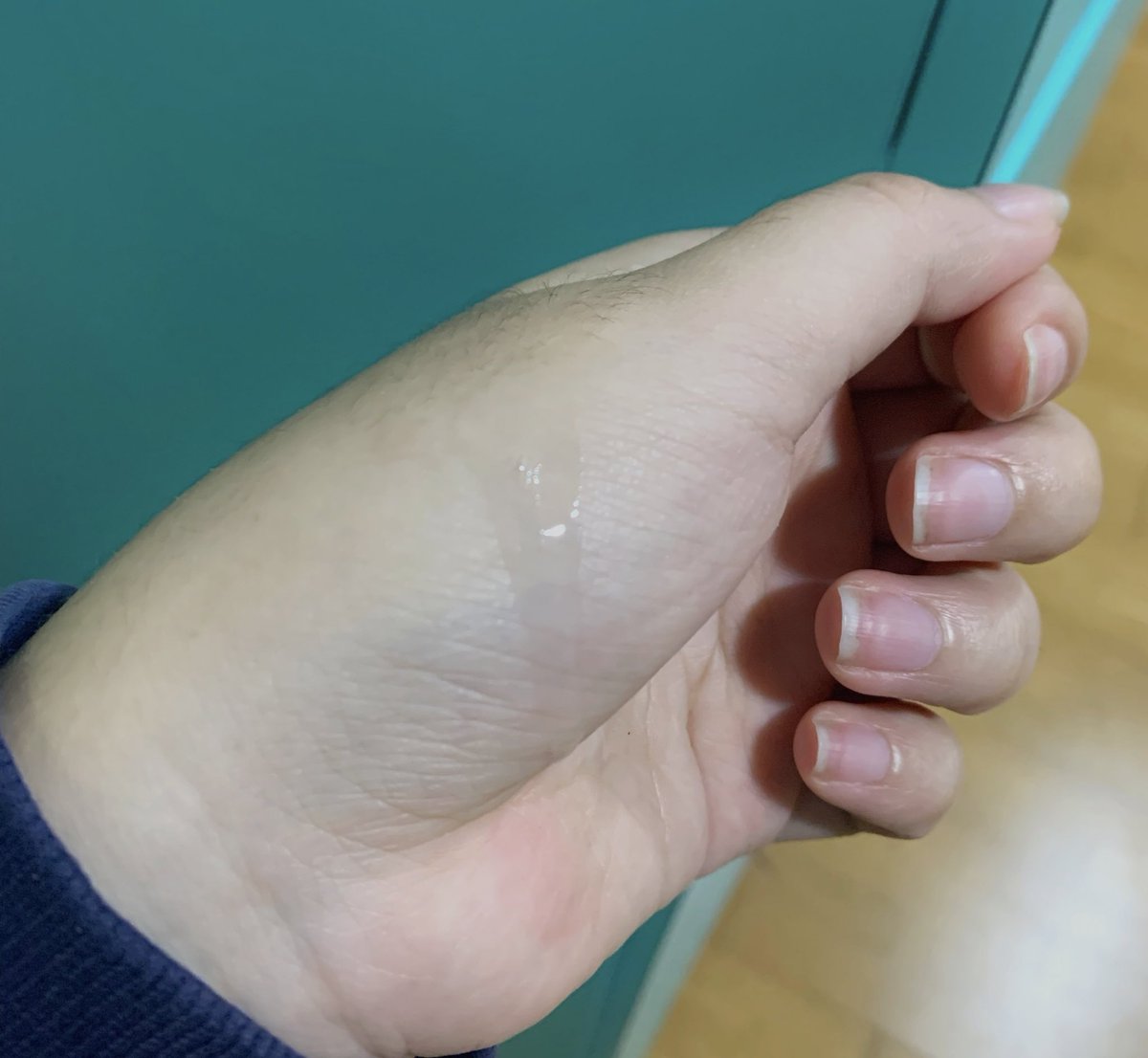 frinazhar's tweet photo. Normally kalau i pakai brightening serum nak nampak beza tu lambat sikit sebab ingredients dia biasa-bisa je. 

BUT this time around i guna product yang ada 8 brightening ingredient in 1 serum!! 

Sesuai gila guna untuk parut jenis degil nak hilang😩

#C8Yourself #NaturesPalette https://t.co/aovGbfh2pe