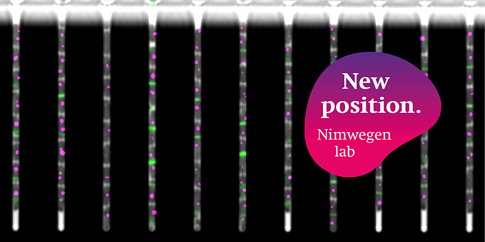 biozentrum's tweet photo. Job advertisement Group Erik van Nimwegen

Postdoc position: quantitative biology of non-growing bacteria (100%)

https://t.co/na2GTWnpQB

@biozentrum @UniBasel_en
#Biozentrum #Basel #research #science #joboffer #scientific #postdoc https://t.co/KGnIPrGvDD