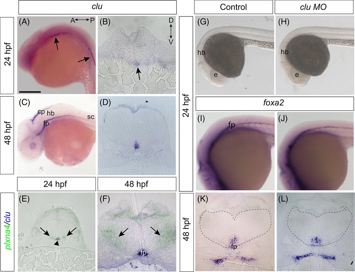 During nervous system development #neurons are initially overproduced but then pruned through #apoptosis. Learn how #plxna4 is required for neuronal survival which has implications for #neurodegenerative disorders such as #Alzheimers #zebrafish  doi.org/10.1002/dvdy.6…