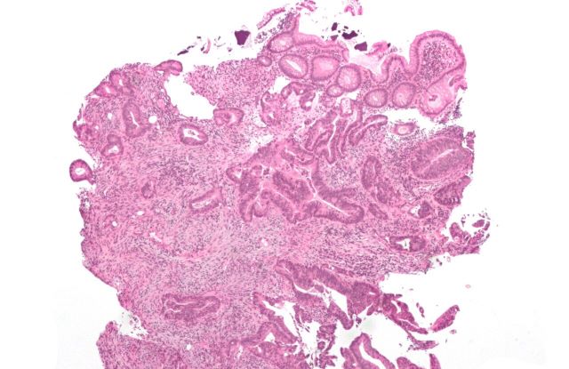 AgenciaFAPESP's tweet photo. Inteligência artificial pode predizer a sobrevida de pacientes com #câncer #colorretal com até 80% de acerto. Estudo indica que algoritmos podem auxiliar na formulação de protocolos de tratamentos e no planejamento dos serviços de saúde | https://t.co/WuptKw9eza