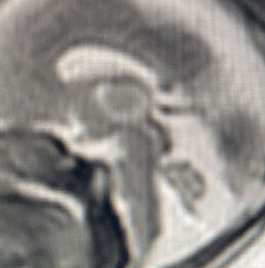 Dr Kish Mankad tweet media