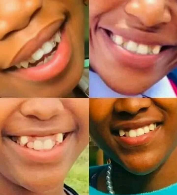 angelferxoxo's tweet photo. Facts about women with these kind of teeth https://t.co/3i3rlwX8pX