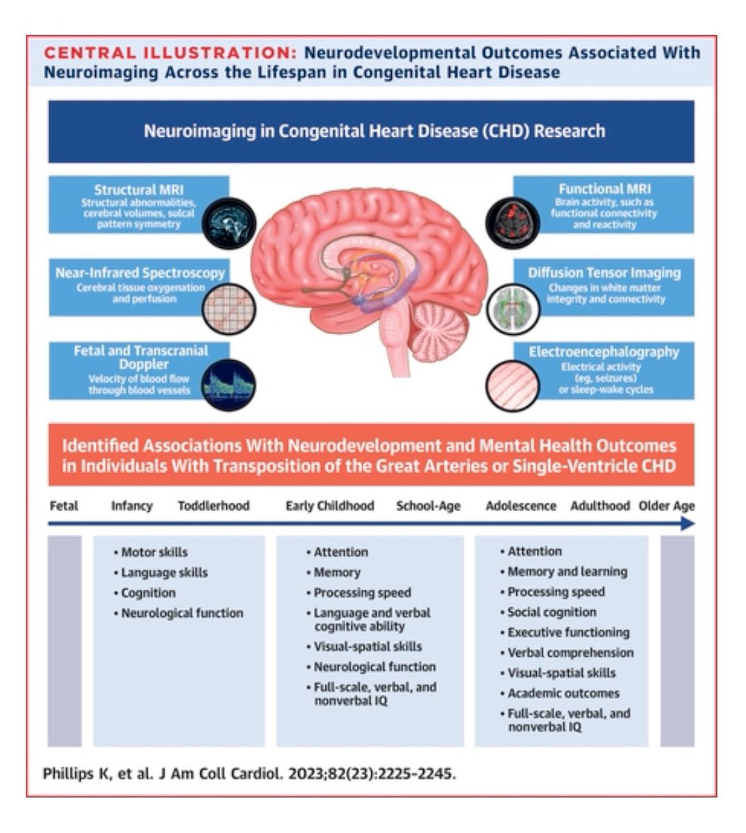 Neuroimaging & Neurodevelopmental Outcomes Among Individuals With Complex Congenital #HeartDisease: JACC State-of-the-Art Review @katelyn @Dr_BCallaghan @JACCJournals Brain health across the lifespan in patients with TGA or SVCHD jacc.org/doi/10.1016/j.…