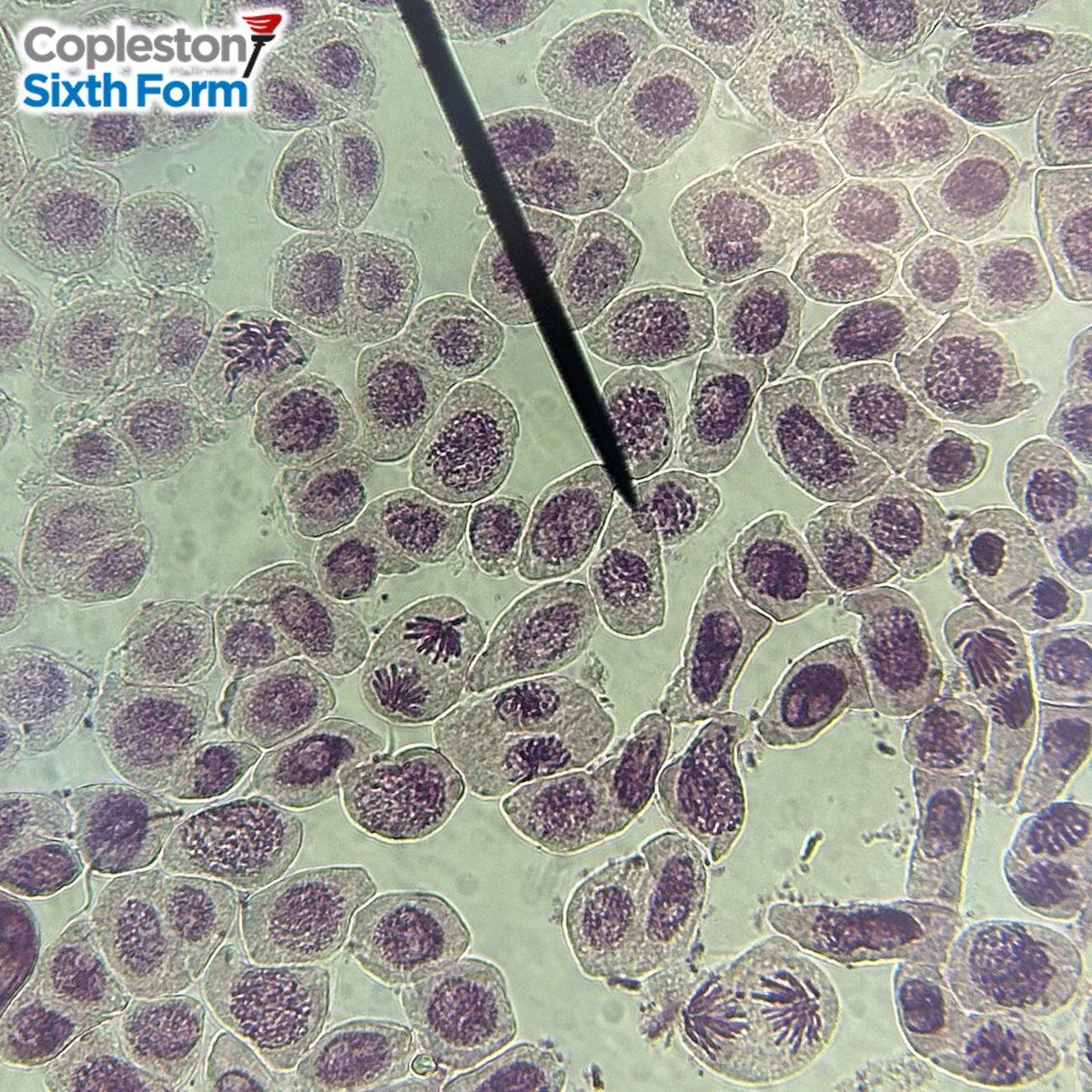 Some superb microscopy work from our Year 12 Biology students who prepared their own slides to view the stages of mitosis in garlic root tips. It is quite rare to see so many stages in a single photo! #ALevelBiology #SixthForm <a href="/chatbiology/">Chat Biology</a> <a href="/OCR_Science/">Cambridge OCR Science</a> <a href="/SAPS_News/">SAPS</a>