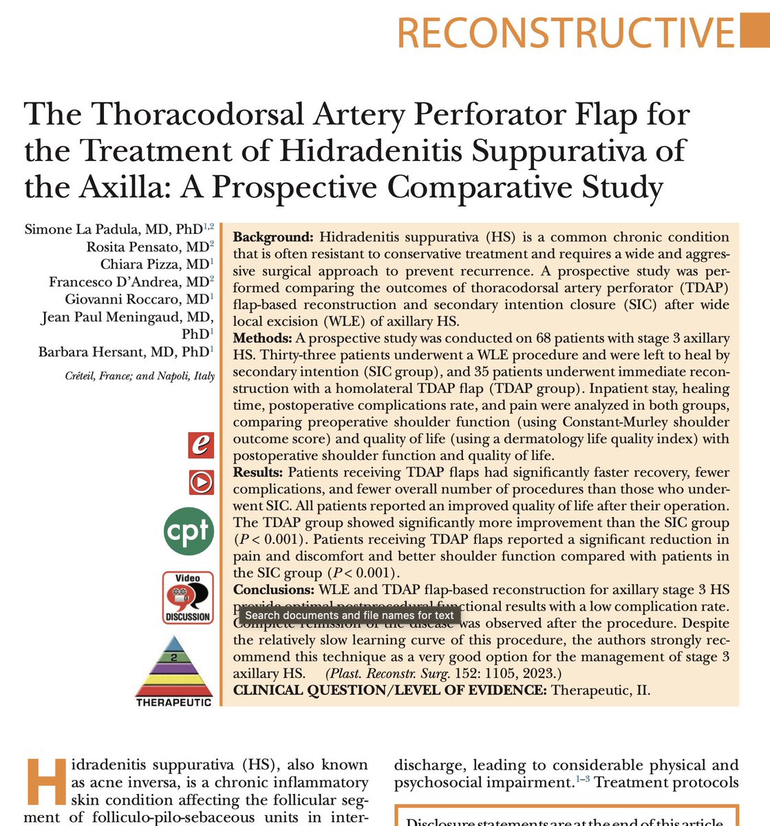Hidradenitis suppurativa is a painful and disfiguring disease. The use of TDAP flap was shown to be an effective solution to replace excised diseased tissue. An elegant option that should be considered for this condition. @PRSJournal #PlasticSurgery bit.ly/492Awd9