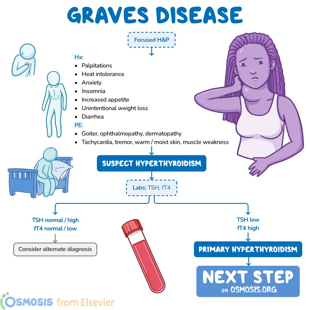 OsmosisMed's tweet photo. Today's #DecisionTreeBranch is about Graves disease. It's an autoimmune condition characterized by TSH-receptor antibodies that bind to TSH receptors on thyroid cells, stimulating them to produce thyroid hormones, thus causing hyperthyroidism.
Learn more: https://t.co/Mw2DHnwSFn https://t.co/IPKeaN0A3z