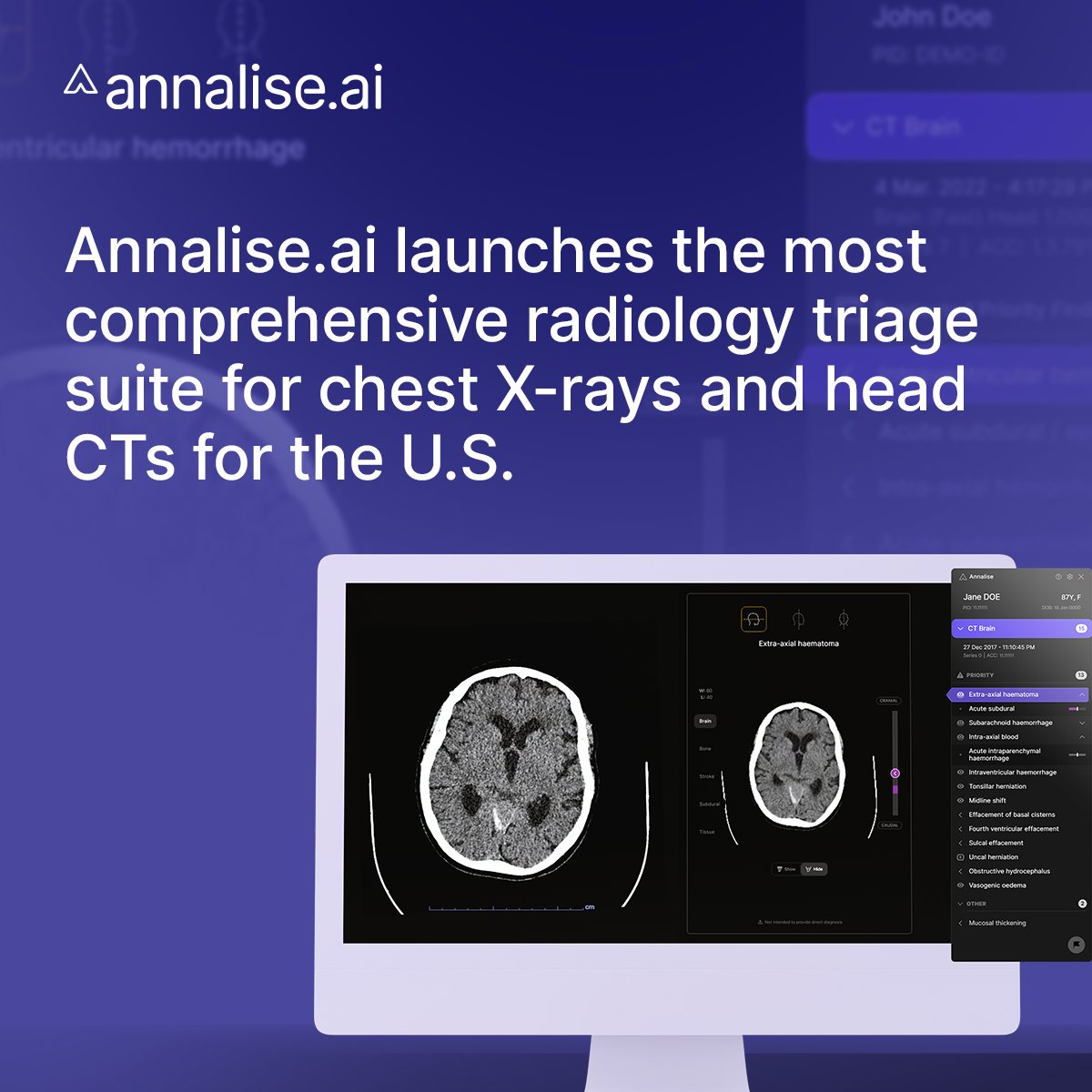 Ever wondered what makes an #AI solution truly comprehensive?
#ComprehensiveAI means 
1️⃣ Breadth of Coverage
2️⃣ Depth of Coverage
3️⃣ Reach of the Product

Head over to Annalise.ai booth to learn about our latest product additions to make it even more comprehensive.