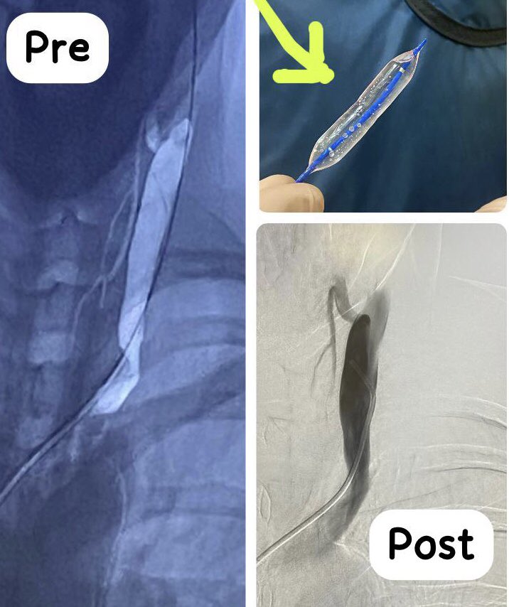 Paolo Zamboni tweet media