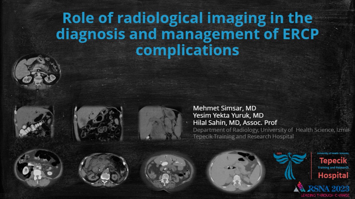 Hilal Şahin (@hilalsahin_md) on Twitter photo Have a time to look at our great EPOS by Mehmet Simsar and <a href="/yesimyektayuruk/">mdyesimyekta</a> at RSNA 2023. Fantastic review on ERCP complications!
rsna.apprisor.org/index.cfm?k=81… Have a time to look at our great EPOS by Mehmet Simsar and <a href="/yesimyektayuruk/">mdyesimyekta</a> at RSNA 2023. Fantastic review on ERCP complications!
rsna.apprisor.org/index.cfm?k=81…
