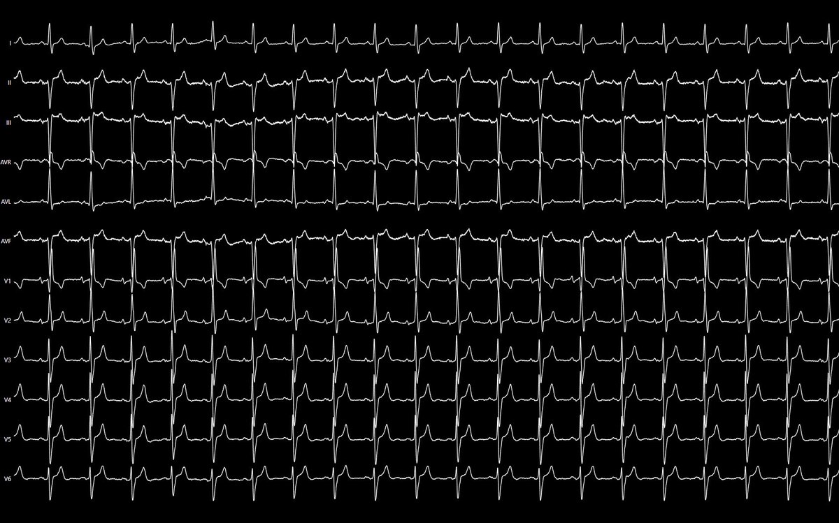 José Alderete M tweet media
