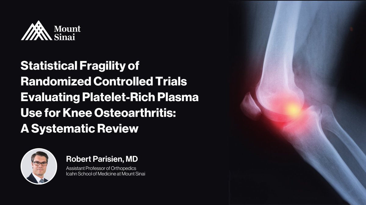 New article featuring @RobertLParisien as the senior author on Statistical Fragility of Randomized Controlled Trials Evaluating Platelet-Rich Plasma Use for Knee Osteoarthritis: A Systematic Review! Read the full article here: journals.sagepub.com/doi/epdf/10.11…