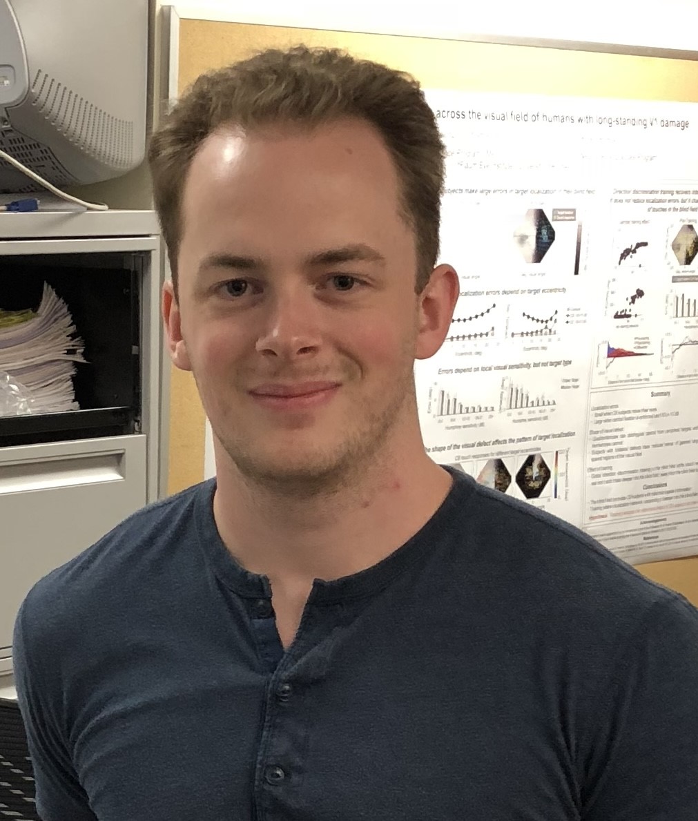 New blog article! Flaum researchers publish a paper highlighting the need for better vision care for stroke survivors. 

Read here: urmc.rochester.edu/eye-institute/…