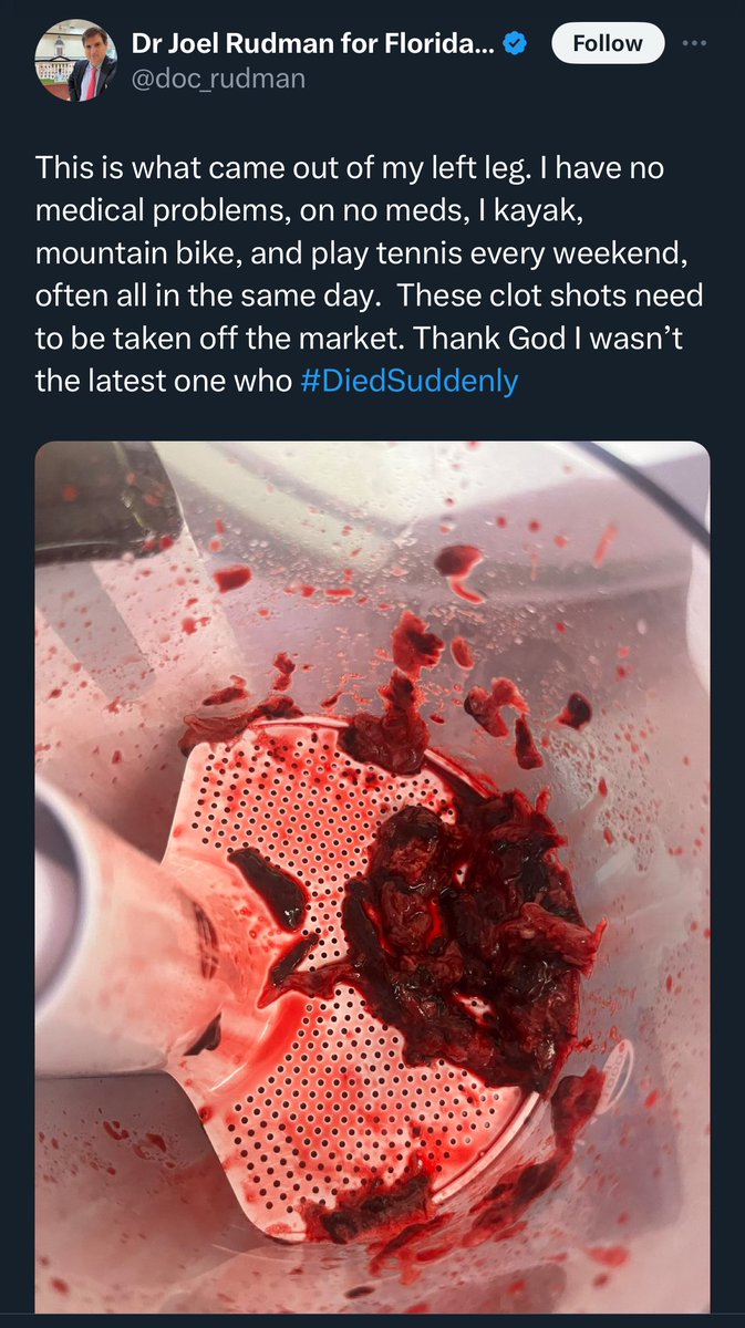 Keith Siau tweet media