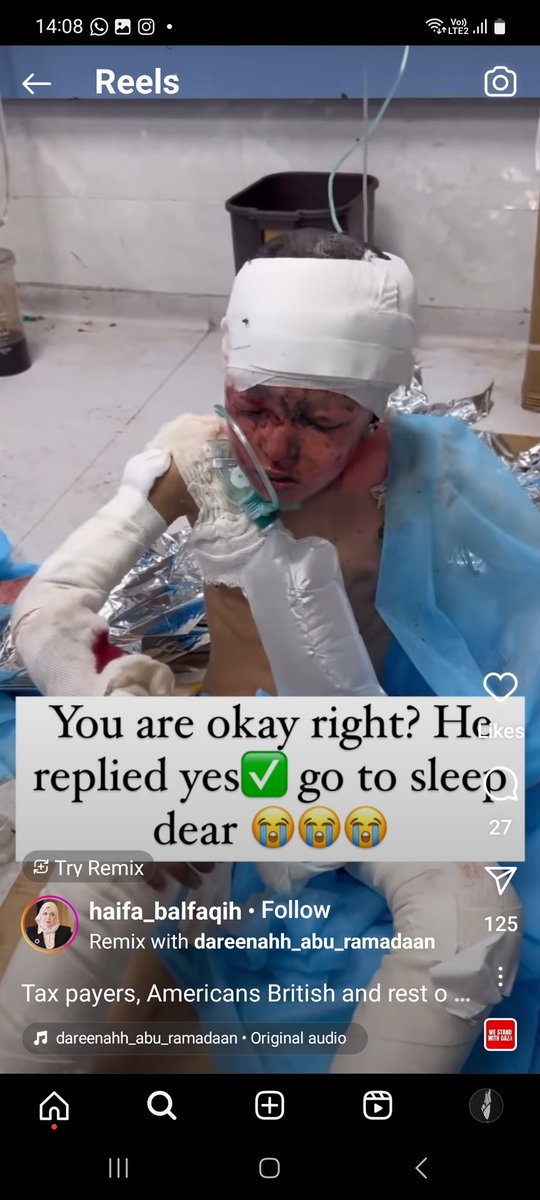 DahlanHala's tweet photo. No justificatio for the fear,trauma,and pain this child went through. Let Gaza children live. 
#IsraelisaGenocidalState 
#IsraelIsATerrorist 
#IsraeliWarCrimes 
#GazaGenocide 
#StopGazaNakba 
#CeasefireNowInGaza 
#CeasefireNOW 
#OpenRafahBorderForGaza 
#OpenRafahCrossing https://t.co/5zk4Tt1iZm
