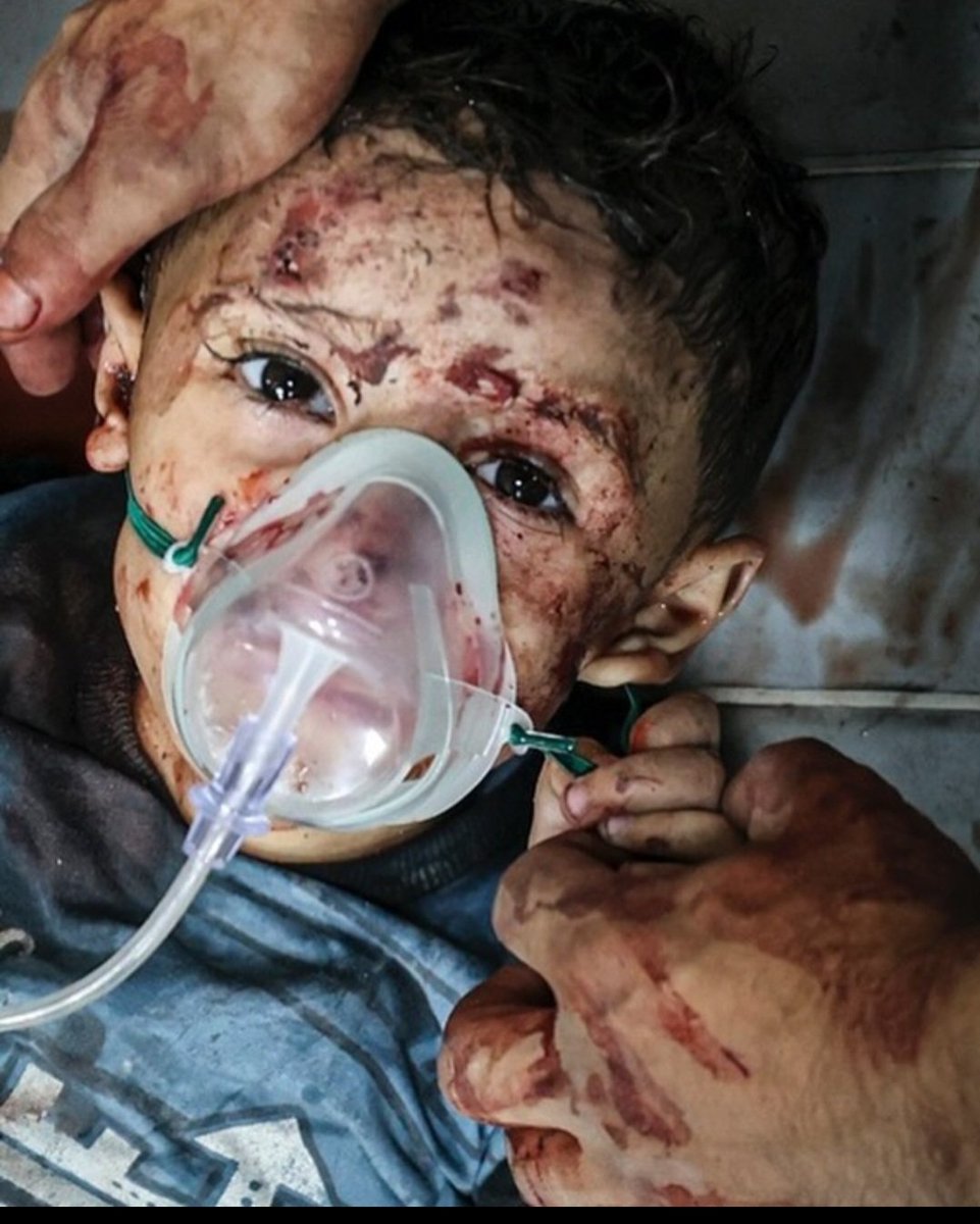 DahlanHala's tweet photo. Look him in the eye and promise him you will not keep silent!speak up for the lives of Gaza children. 
#IsraelisaGenocidalState 
#IsraelIsATerrorist
#IsraeliWarCrimes 
#GazaGenocide 
#StopGazaNakba 
#CeasefireNowInGaza 
#CeasefireNOW 
#OpenRafahBorderForGaza 
#OpenRafahCrossing https://t.co/7uqtu2QRqF