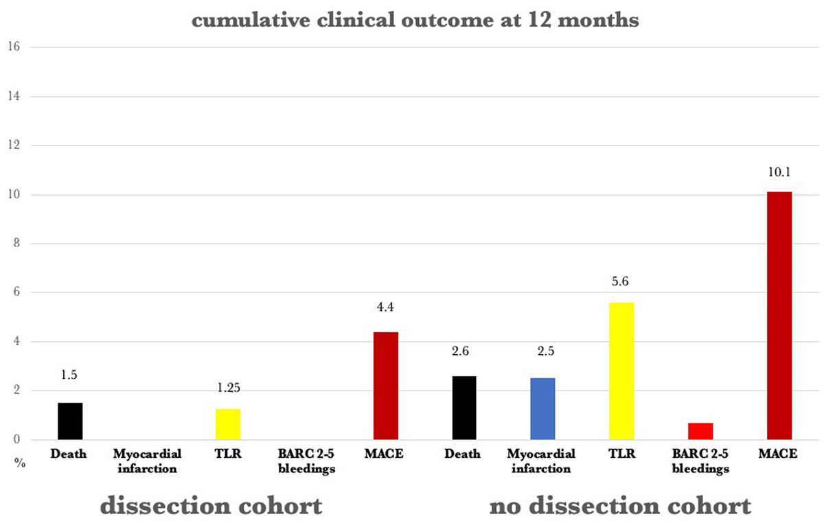 In a 73-patient subgroup analysis of the EASTBOURNE study of consecutive patients treated with new-generation sirolimus DCB, dissections left untreated after angioplasty did not lead to an increase in adverse events onlinelibrary.wiley.com/doi/full/10.10… @ccijournal