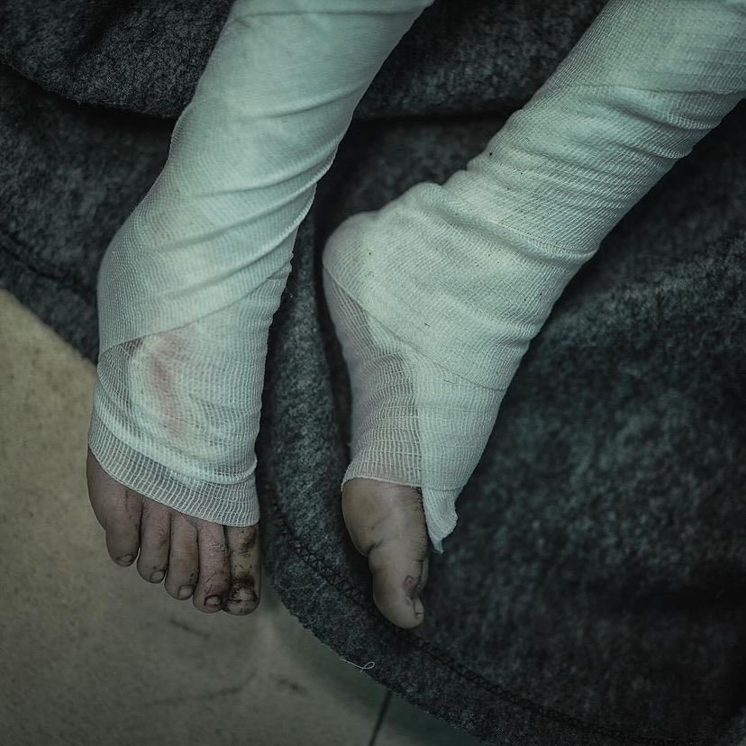 Children in Gaza have been witnessing endless violence by the Israeli forces. 

These children don’t deserve what they are currently experiencing.

40 days of violence and brutality.