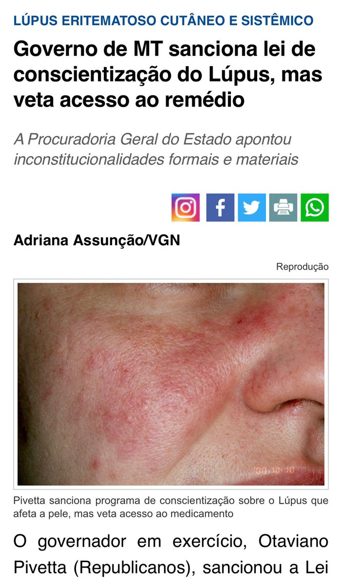 lupusnomundo's tweet photo. Olhem essa notícia,  Governo do MT simplesmente sanciona lei conscientização para lúpus mas veta para parte de protetor solar ( medicamentos) como inconstitucional porém isso não procede pois protetor já é fornecido em outros estados, e protetor...

https://t.co/xvJ4d1ggnr https://t.co/GhIA3hUhS3