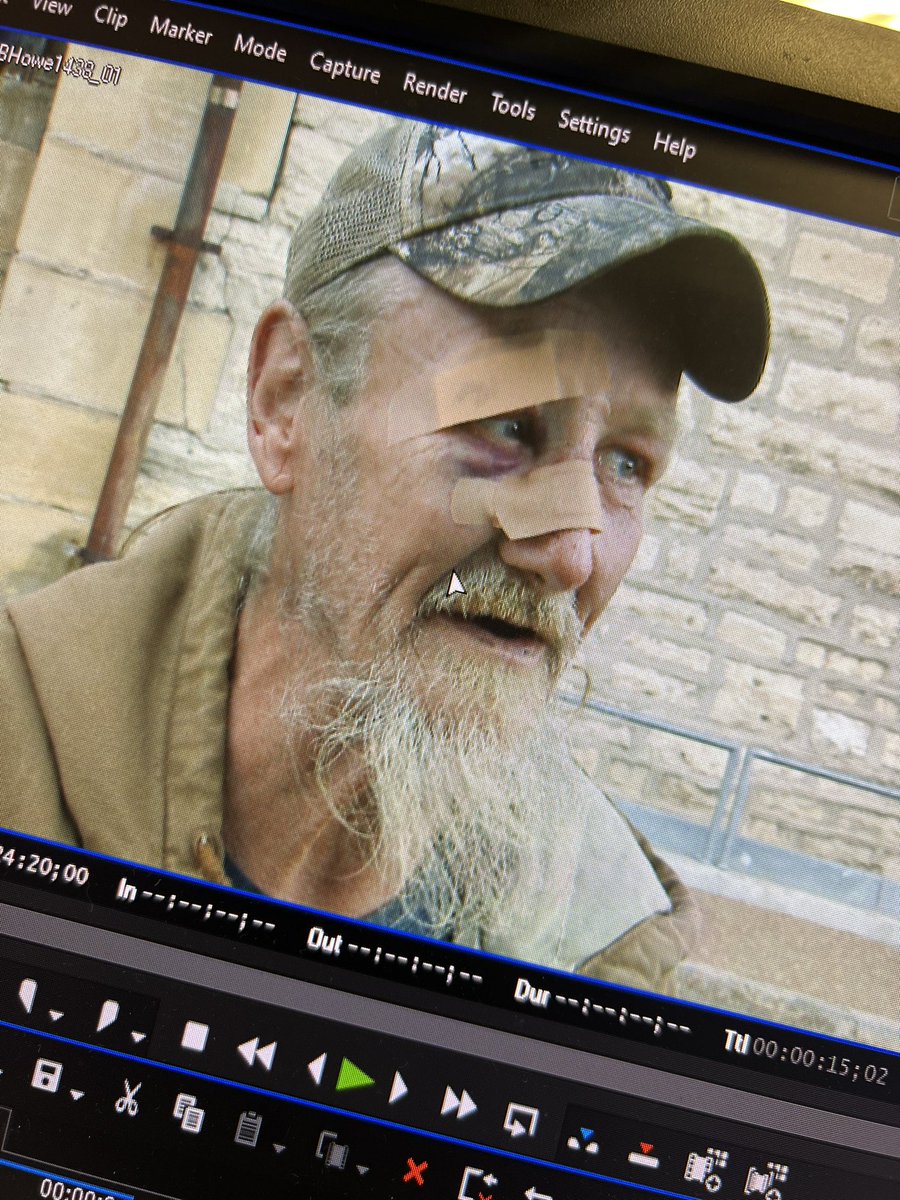 Justin_EAndrews's tweet photo. #OnlyOn4: A man beaten on a @STLMetro train before his attacker tossed a rock at his face. He details the attack and I’m looking into promise from Metro to protect passengers. @KMOV https://t.co/zaO5y03355