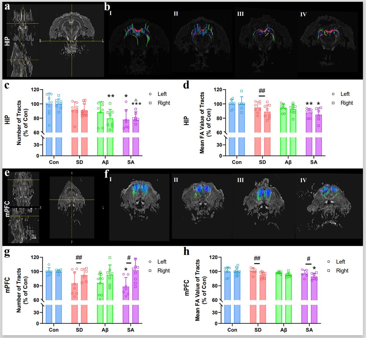 GeroScienceAGE's tweet image. 📢New in GeroScience
Lateralized brunt of sleep deprivation on white matter injury in a rat model of Alzheimer’s disease by Xin Mao et al.
link.springer.com/article/10.100…
#sleepdeprivation #AlzheimersDisease #DiffusionTensorImaging #whitematter