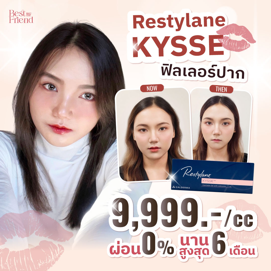 💋ปากสวยฉ่ำ น่าจุ๊บ ต้องฟิลเลอร์ 𝐑𝐞𝐬𝐭𝐲𝐥𝐚𝐧𝐞 𝐊𝐘𝐒𝐒𝐄🍒เท่านั้น

🔥1 cc 9,999.-🔥
รีบจองด่วน ก่อนหมดโปร

𝐑𝐞𝐬𝐭𝐲𝐥𝐚𝐧𝐞 𝐊𝐘𝐒𝐒𝐄
🍒เป็นฟิลเลอร์ที่ออกแบบมาเพื่อริมฝีปากโดยเฉพาะ
🍒เพิ่มความชุ่มชื้นให้ริมฝีปาก ปรับสีปากให้แลดูอมชมพูสุขภาพดี
🍒เนื้อฟิลเลอร์นิ่ม