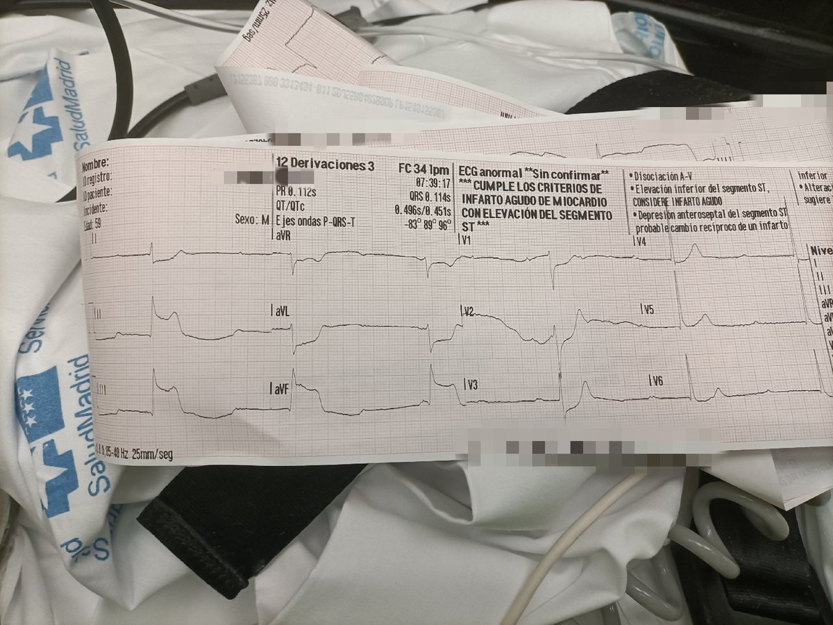ismacercedilla's tweet photo. En patologías tiempo dependientes graves el trabajo en EQUIPO MULTIDISCIPLINAR COORDINADO y PROTOCOLIZADO es ESENCIAL, mejora la supervivencia del paciente, disminuye las secuelas y sufrimiento del paciente #codigoinfarto @SaludMadrid @112cmadrid #SUMMA112 #urgencias #emergencias https://t.co/iDZp2u4Uhv