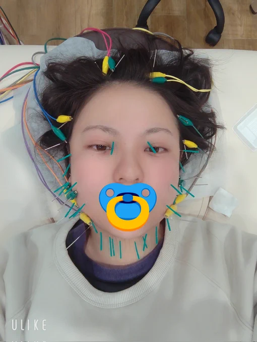 針だらけになってます 