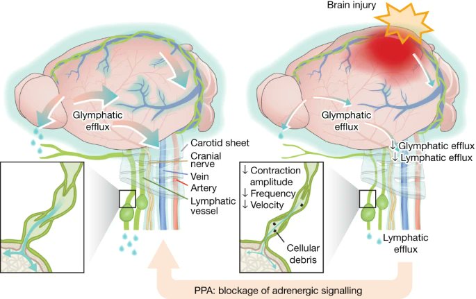 NedergaardLab (@nedergaardlab) on Twitter photo New publication from our Rochester Lab in <a href="/Nature/">nature</a>: We investigated how potentiating glymphatic drainage after TBI minimizes post-traumatic cerebral oedema. Congrats to Rashad and co. together with the Kelley Lab, <a href="/Hiraselab_KU/">Hirase lab@KU</a> Lab, Castorena-Gonzalez Lab,  Goldman Lab, Davis Lab New publication from our Rochester Lab in <a href="/Nature/">nature</a>: We investigated how potentiating glymphatic drainage after TBI minimizes post-traumatic cerebral oedema. Congrats to Rashad and co. together with the Kelley Lab, <a href="/Hiraselab_KU/">Hirase lab@KU</a> Lab, Castorena-Gonzalez Lab,  Goldman Lab, Davis Lab