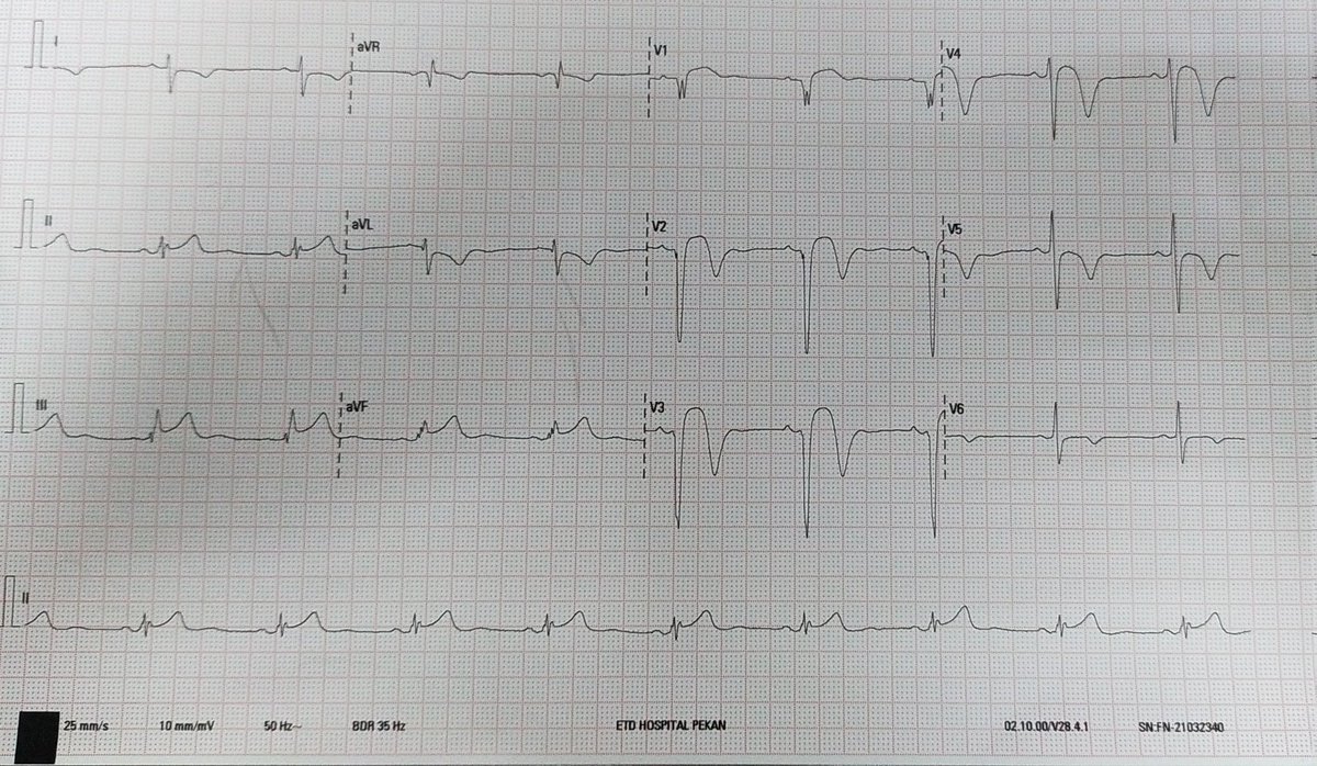 Mohd Anas tweet media