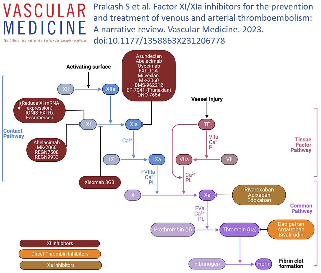 VascularMedicine (@vmj_svm) on Twitter photo Online First! In this review, Dr. Prakash <a href="/GbarnesMD/">Geoff Barnes</a> and colleagues summarize the clinical pharmacology of Factor XI inhibitors and highlight the latest clinical trials exploring the utility of these agents to prevent venous and arterial thromboembolism.
buff.ly/47bMX51 Online First! In this review, Dr. Prakash <a href="/GbarnesMD/">Geoff Barnes</a> and colleagues summarize the clinical pharmacology of Factor XI inhibitors and highlight the latest clinical trials exploring the utility of these agents to prevent venous and arterial thromboembolism.
buff.ly/47bMX51