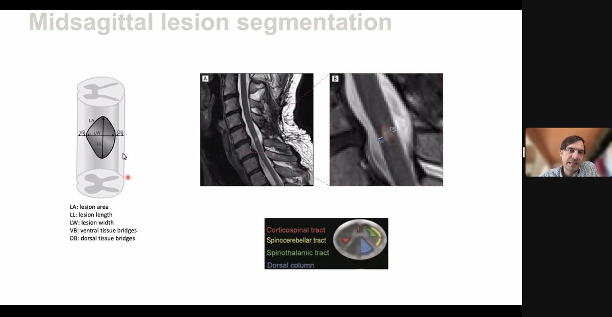 Dr. Patrick Freund of @derbalgrist, @BalgristCampus is leading day 3 of @SpinalCworkshop with a nice talk on imaging in the context of spinal cord injury.