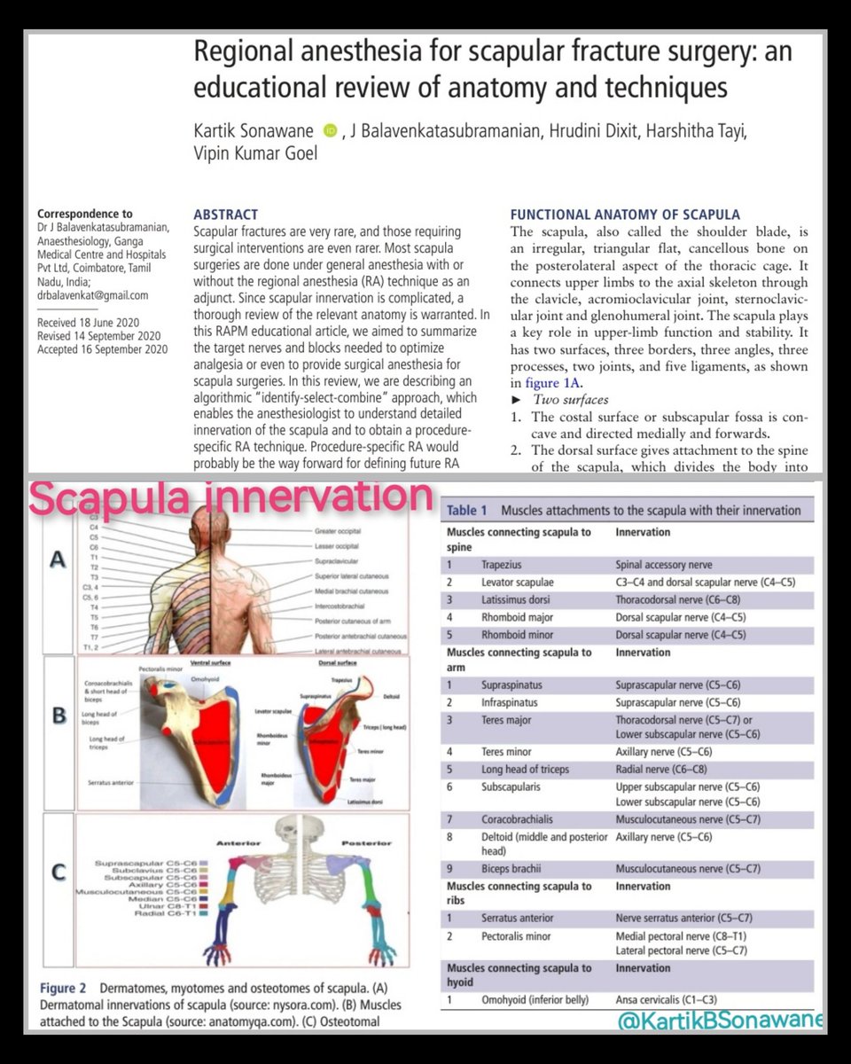 KartikBSonawane's tweet photo. "RA in Scapula Sx"

#RAinScapulaSurgery
#ScapularBlock
#Scapulaanalgesia
#Painmanagementinscapulasurgery

My 10 points:

1. Scapula is complexly innervated Structure. "Identify-Select-Combine" Approach helps to plan RA technique for any such complexly innervated structures.

2. Most of its innervations are  derived from C5 & C6 roots. However, all innervations are derived from cervical and brachial plexus EXCEPT skin of back region.

3. Skin over scapula is supplied by Dorsal Rami (T2-T9/10). For this ESP with Diluted LA will be sufficient.

4. Muscles attached to the scapula are innervated by Brachial Plexus.

5. Understanding Steps of Sx, Positioning of Patient, Duration of Surgery, Incisions,& Innervations of involved structure is essential to plan Suitable RA technique.

6. Planned procedure-Specific RA technique should cover innervation of incisional area (Dermatome) & involved scapula bone (Osteotome).

7. Myotomal coverage needed only for the muscles which are involved in surgical dissection.

8. Myotomal coverage for muscle relaxation is needed only if Surgery will be under Sole RA. For that high conc. LA can be used.

9. For analgesia purpose, Myotomal coverage is not needed. So diluted LA can be used (Motor-Sparing block).

10. Depending upon the surgical plan and extending dissections, Combinations of blocks are required for Scapula surgery. For that knowledge of Spared innervations of primary blocks and knowledge of Supplementary blocks to cover those are essential.

In our Case, We gave Combination of 

SCUT (SupraClavicular + UT) block to involve C5 & C6 + SCN (to cover skin over & above spine of scapula).

SAP to cover Axillary dissection (T2-T9) with LTN & TDN.

ESP to cover skin over the Scapula.