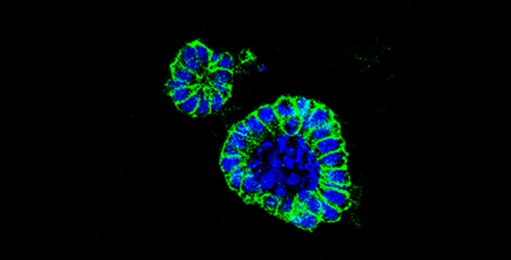 🆕Un nuevo fármaco frente a un transportador de aminoácidos es efectivo en #cáncerdecolon ow.ly/FG2j50Q8jbq 👉 Estudio @CICancer_com, @IBSAL_IIS, @CSIC, @CIBERONC