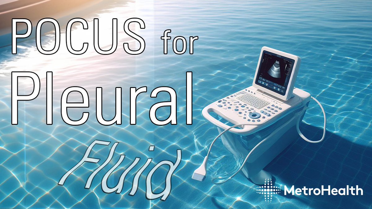 MetroHealth Emergency Ultrasound (@mh_emultrasound) on Twitter photo Check out the latest video about POCUS for Pleural Fluid by <a href="/mtabbut/">Matt Tabbut, MD</a>
youtu.be/YBkMLK7iTnc
#MetroEUS #POCUS #Ultrasound Check out the latest video about POCUS for Pleural Fluid by <a href="/mtabbut/">Matt Tabbut, MD</a>
youtu.be/YBkMLK7iTnc
#MetroEUS #POCUS #Ultrasound