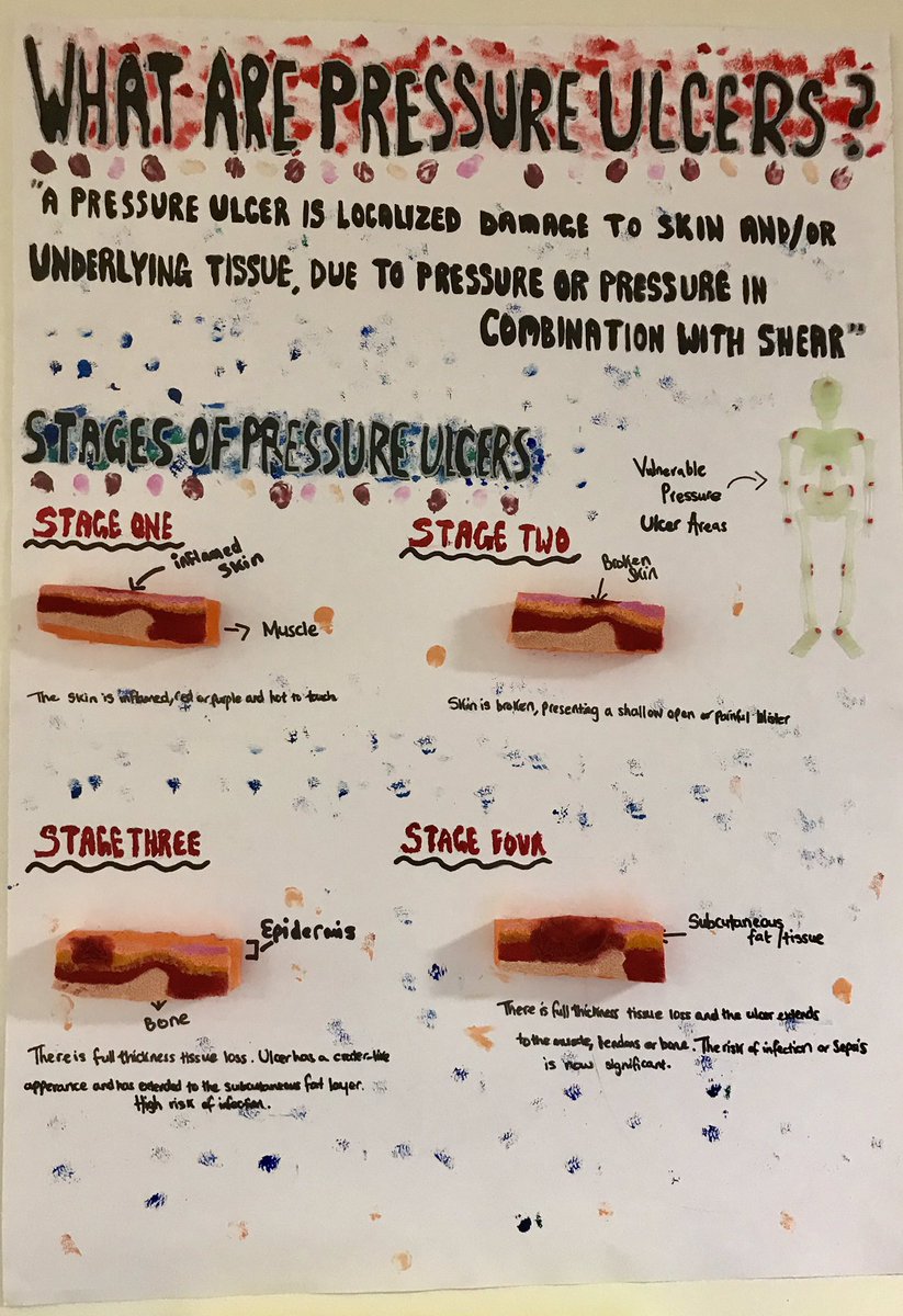 sianymarv's tweet image. Fabulous poster displays for Stop Pressure Damage Week! Well done to all the ward staff who helped with these creations! #TeamPPH #Tissueviability #Stoppressuredamage #Patientsafety @HywelDdaHB @NSTHywelDda @meinir23 @MelRichards14